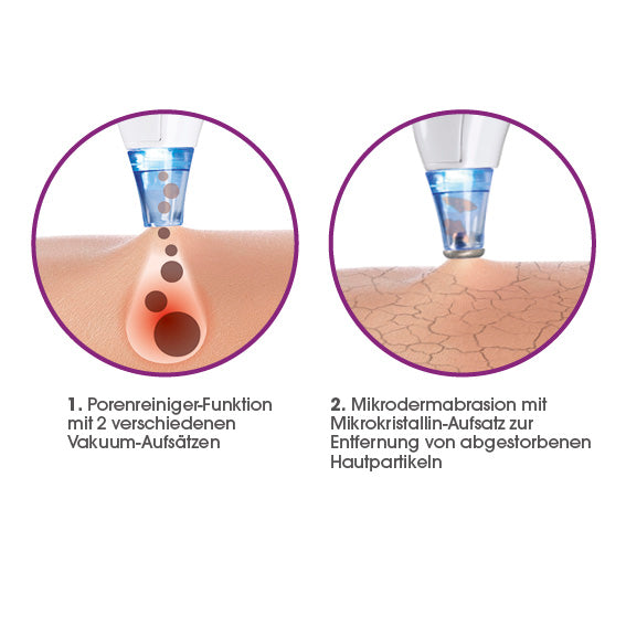 Porenreiniger 5-tlg. mit Aufsatz für Mikrodermabrasion