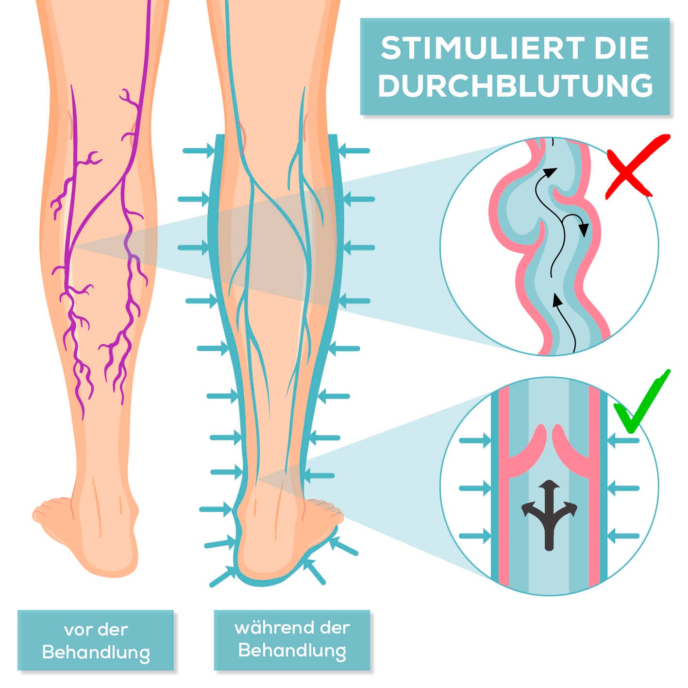 Therapiegerät VenenWalker Basic zeigt venöse Durchblutung vor und während der Behandlung zur Linderung von Venenleiden.
