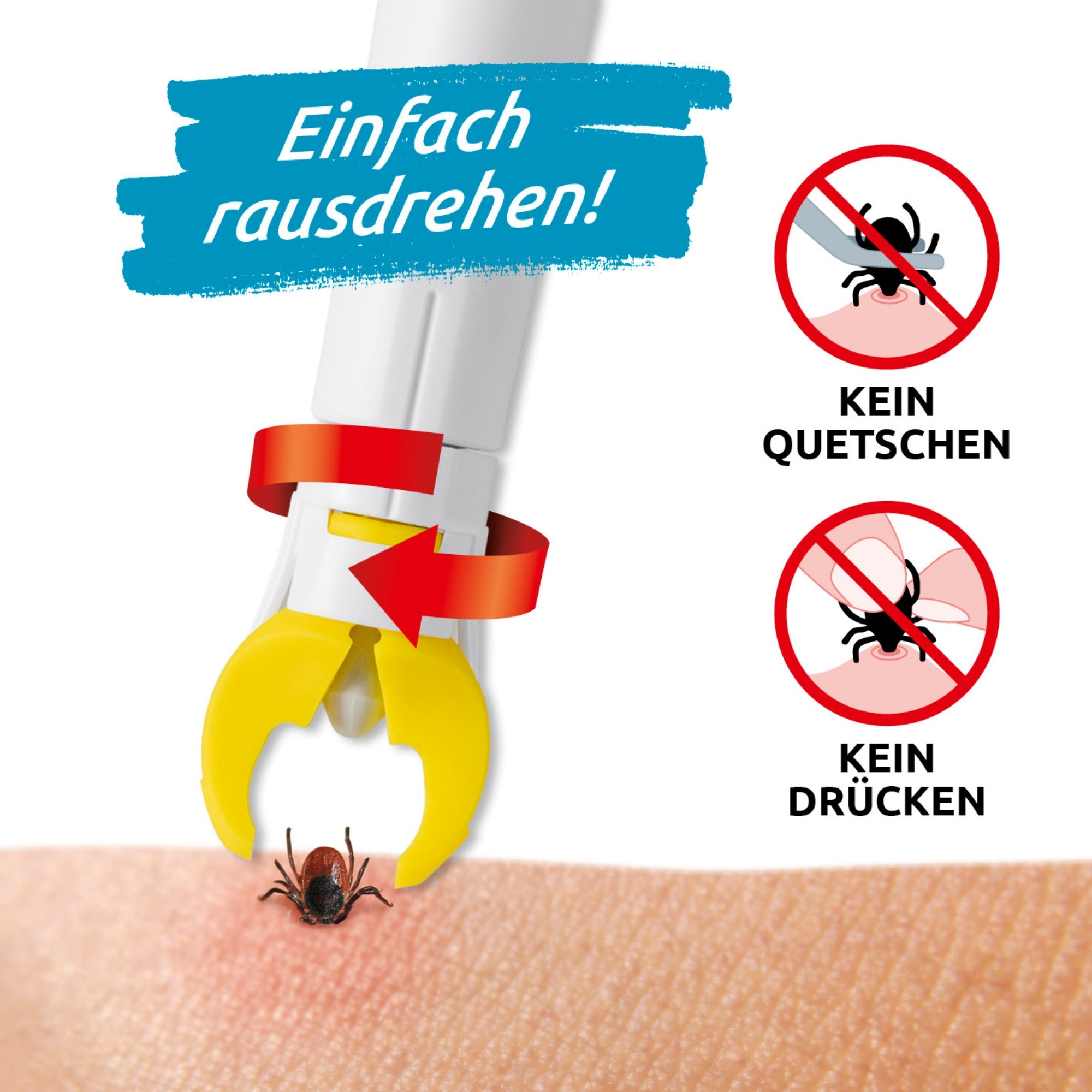 Zeckengreifer für Mensch & Tier mit rotierendem Greiferkopf - 2er-Set