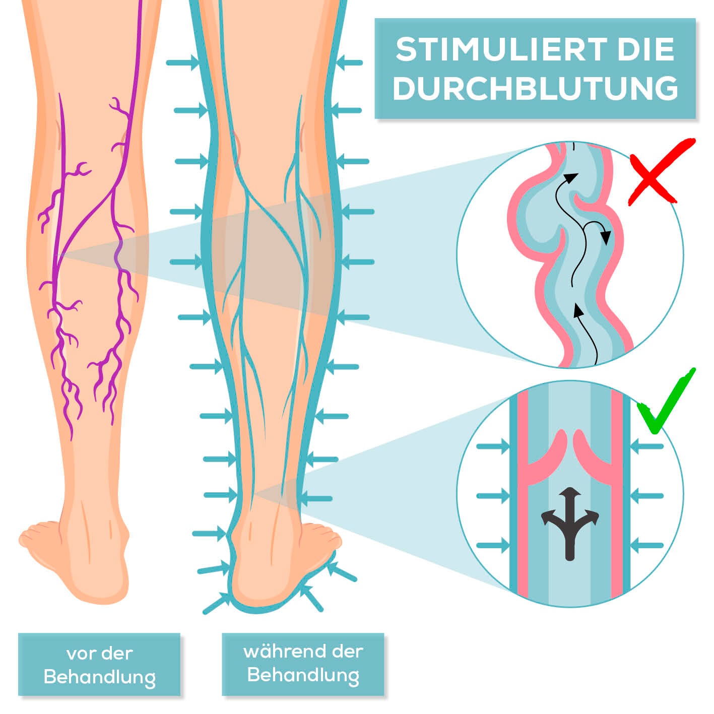 Therapiegerät VenenWalker Pro2