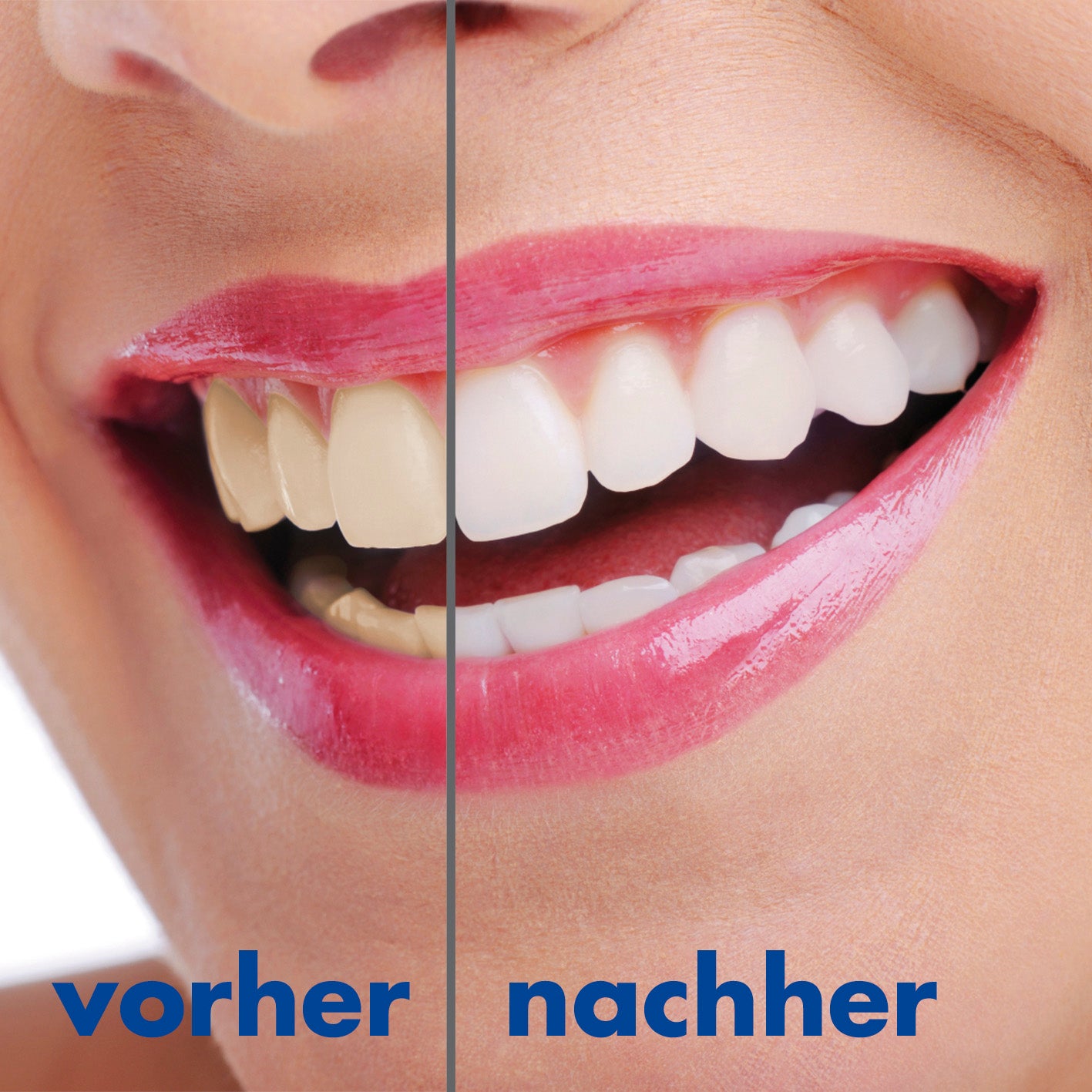 Schall-Zahnbürste - 360°-Borsten - Mit Vibrationsfunktion - weiß