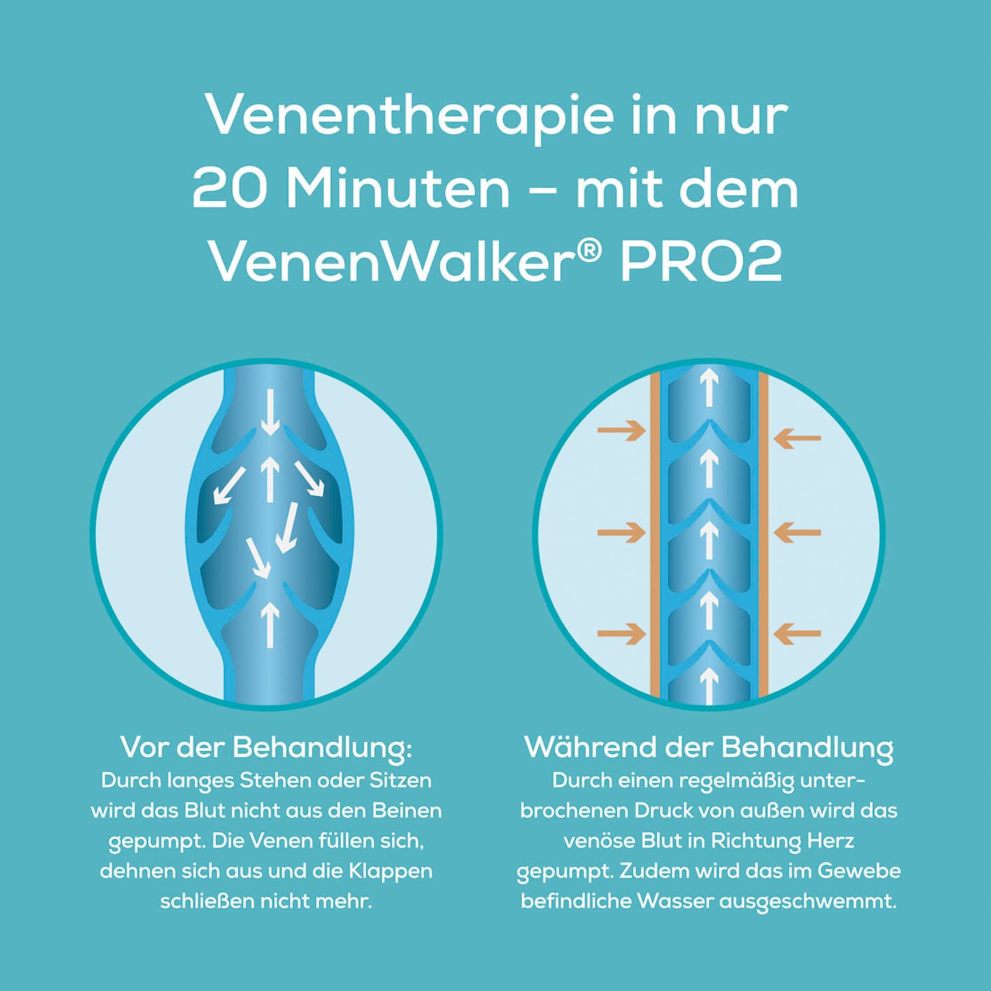 Therapiegerät VenenWalker Pro2 230V, weiß/türkis